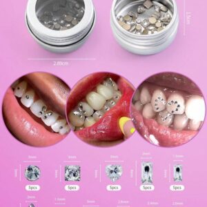 NOVANI KIT DE PIERRES DECORATIVES POUR DENTS CLASSE