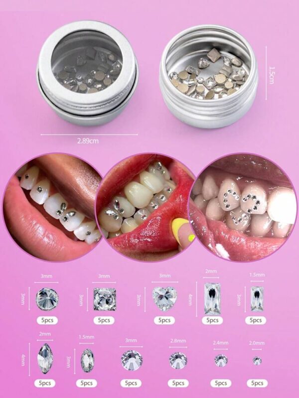 NOVANI KIT DE PIERRES DECORATIVES POUR DENTS CLASSE
