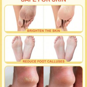 SlowSunday Peach Exfoliating Foot Peel Mask Repair Heels & Removes Dry Dead Skin- Peeling for Cracked Foot