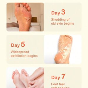 SlowSunday Peach Exfoliating Foot Peel Mask Repair Heels & Removes Dry Dead Skin- Peeling for Cracked Foot