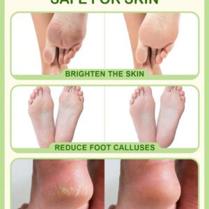 SlowSunday Peach Exfoliating Foot Peel Mask Repair Heels & Removes Dry Dead Skin- Peeling for Cracked Foot