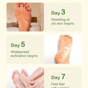 SlowSunday Peach Exfoliating Foot Peel Mask Repair Heels & Removes Dry Dead Skin- Peeling for Cracked Foot