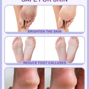SlowSunday Peach Exfoliating Foot Peel Mask Repair Heels & Removes Dry Dead Skin- Peeling for Cracked Foot