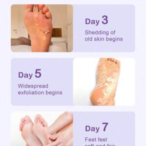 SlowSunday Peach Exfoliating Foot Peel Mask Repair Heels & Removes Dry Dead Skin- Peeling for Cracked Foot
