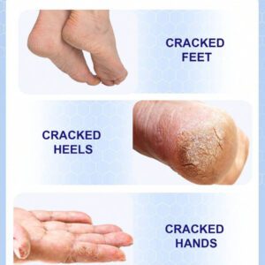 SlowSunday Salicylic Acid Moisturizing Foot Stick