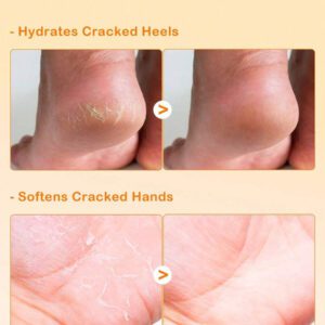 SlowSunday Salicylic Acid Moisturizing Foot Stick
