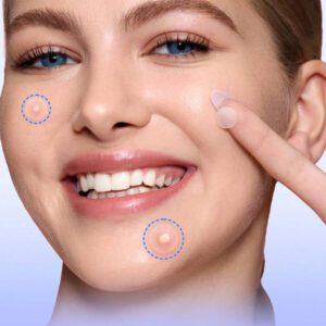 Patch transparent pour imperfections SlowSunday